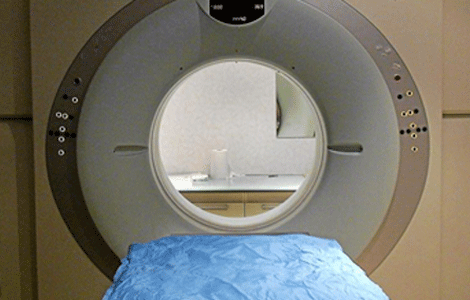 Tecnicos Radiologos: La radioterapia en la pubertad puede aumentar el ...