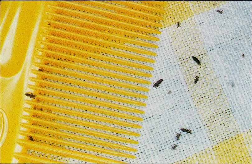 Head Lice Hair comb