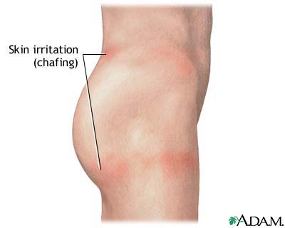 anti%2B%2Bchafing%2Bproduct.jpg