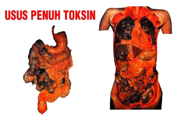 http://1.bp.blogspot.com/_MBiam1nXZ34/TJxfdYHQTUI/AAAAAAAAADs/jIKZuuM_h2c/s1600/usus+toksin.gif