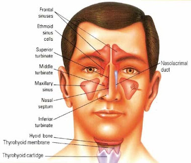 Sinusitis