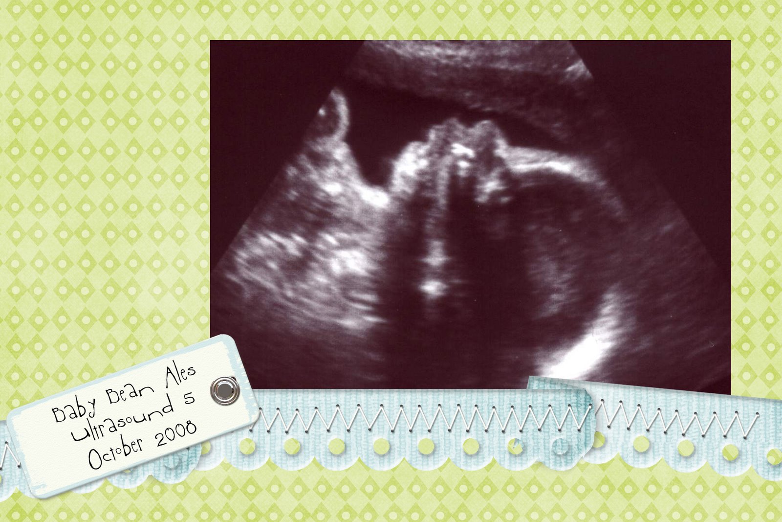 [Baby+Bean+Ultrasound+5a+copy.jpg]