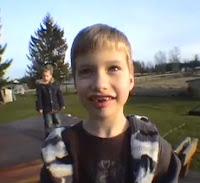  How to Pull Out a Tooth With a Rocket