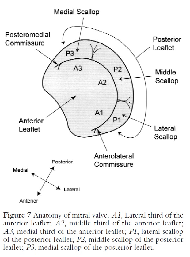 Nuclear Cardiology: Transesophageal Echo