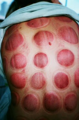 Korean Medicine