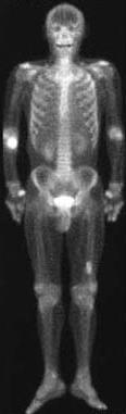 [PetScan.JPG]