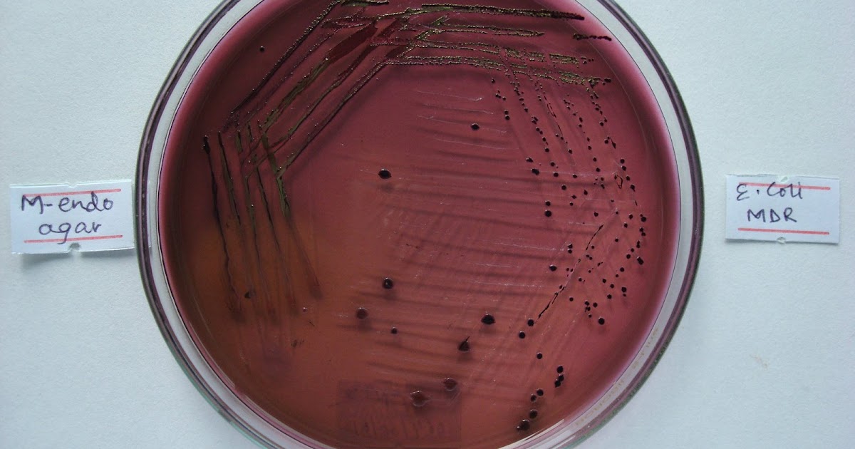 My Interest in Isolation and Identification of Escherichia coli from