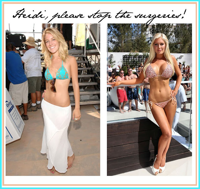 heidi montag before and after. Heidi Montag used to be