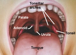 Tonsil Surgery Adults Recovery Time : How To Obtain A Receding Gums Treatment