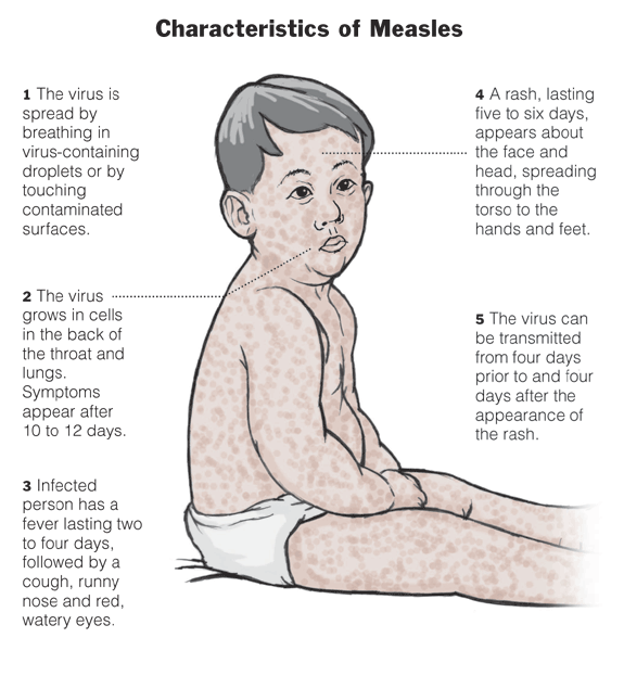 Are Measles Contagious