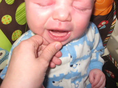 baby tooth bud