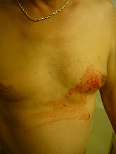 Blood on the Man's Chest