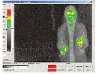 IR Technology Aids in the Battle against SARS IR Technology Aids in the Battle against SARS