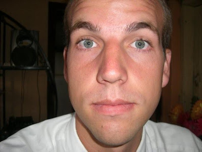 Weird Colored Eyes