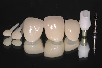 Zirconia Teeth