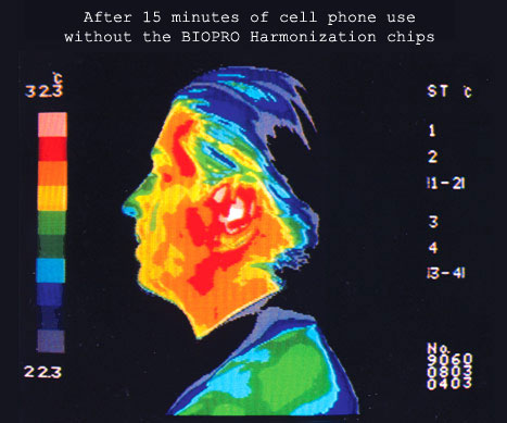 Cell Phone Radiation Penetration Of The Skull