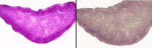 Glycogen in the Liver (left stained to show glycogen, right normal)
