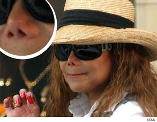 LaToya Jackson's nose job