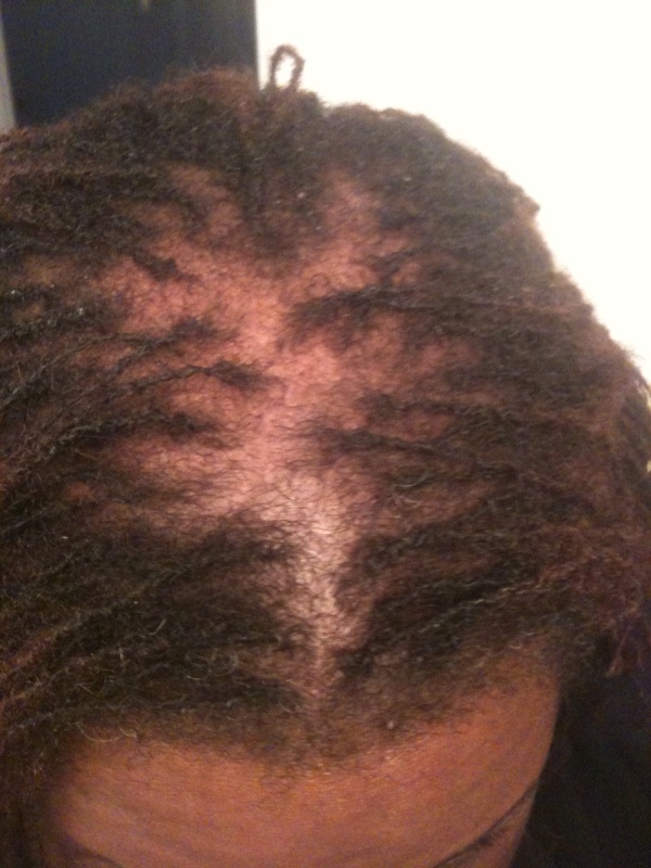 Sisterlock Journey Fine Hair | naturallytequila sisterlocks journey Sisterlock Journey Fine Hair | naturallytequila sisterlocks journey