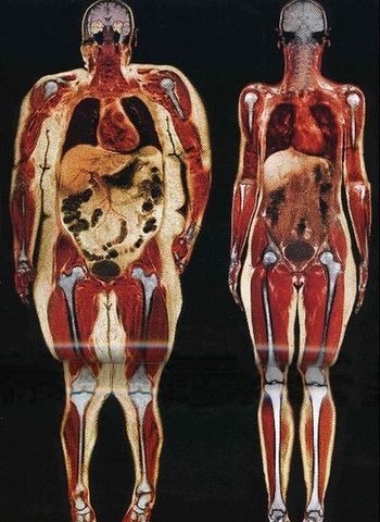 fat-and-skinny-xray.jpg