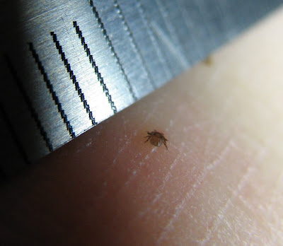 In the Field: Deer Tick Larva