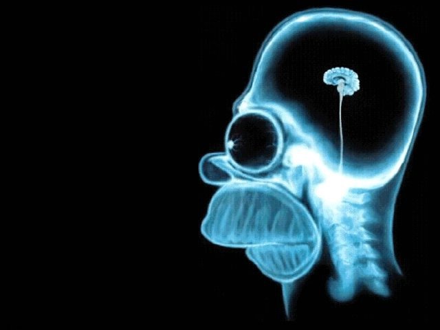 [brain.bmp]