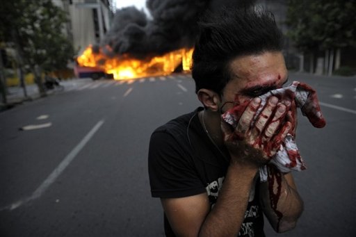 [injured+supporter+Mir+Hossein+Mousavi+covers+face+during+riots+in+Tehran+on+June+13.+Amnesty+International+says+it+believes+that+up+to+10+people+killed+post-election+protests+Iran.jpg]