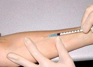 DNUR�09: APA ITU MANTOUX TEST??
