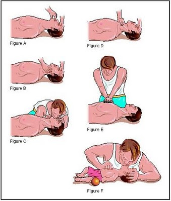 Cpr Cab