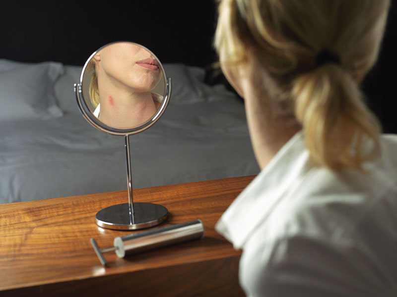 [traces_lovebite_06_02_a.jpg]