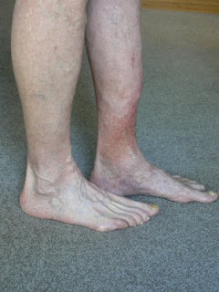 GaryMoller.com - Health, Fitness - Naturally!: Help needed for poor
