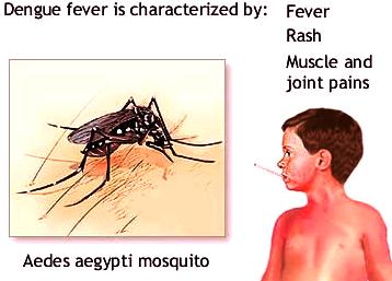 symptoms malaria