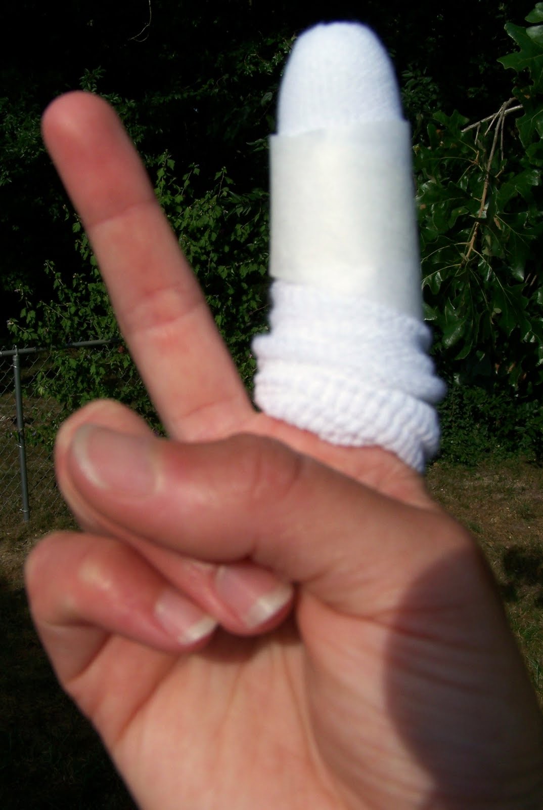 Erraticbliss Smashed Finger In Car Door Got Stitches
