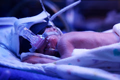 Phototherapy and CPAP