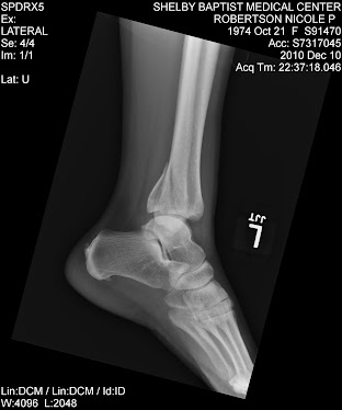 x ray on the night of injury