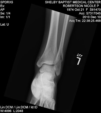 x ray #4 on the night of injury