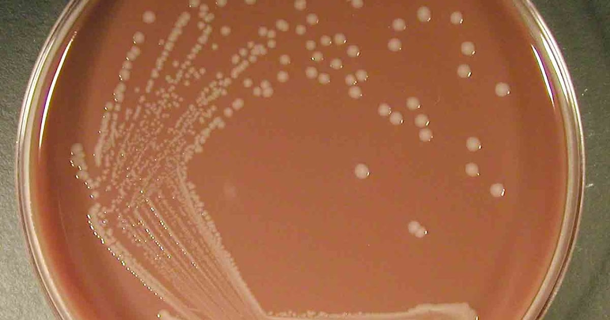 Figs in my belly Food Science? Chocolate Agar Plate