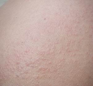 skin anjnai