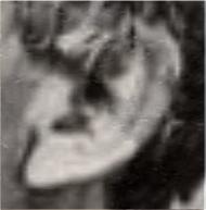 [lawrenceear2.jpg]