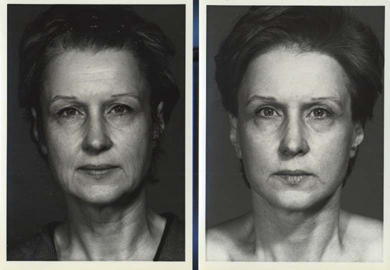 A Rolling Crone Is Plastic Surgery a Sin? (Re My Vogue article)