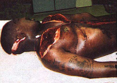 Tupac+autopsy+pictures