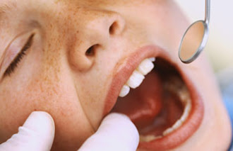 Visite seu Cirugião Dentista
