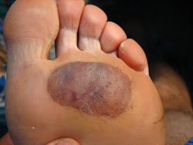 Get South America For Two The Biggest Blood Blister Of All Free HD Get Wallpaper South America For Two The Biggest Blood Blister Of All For iPhone Free