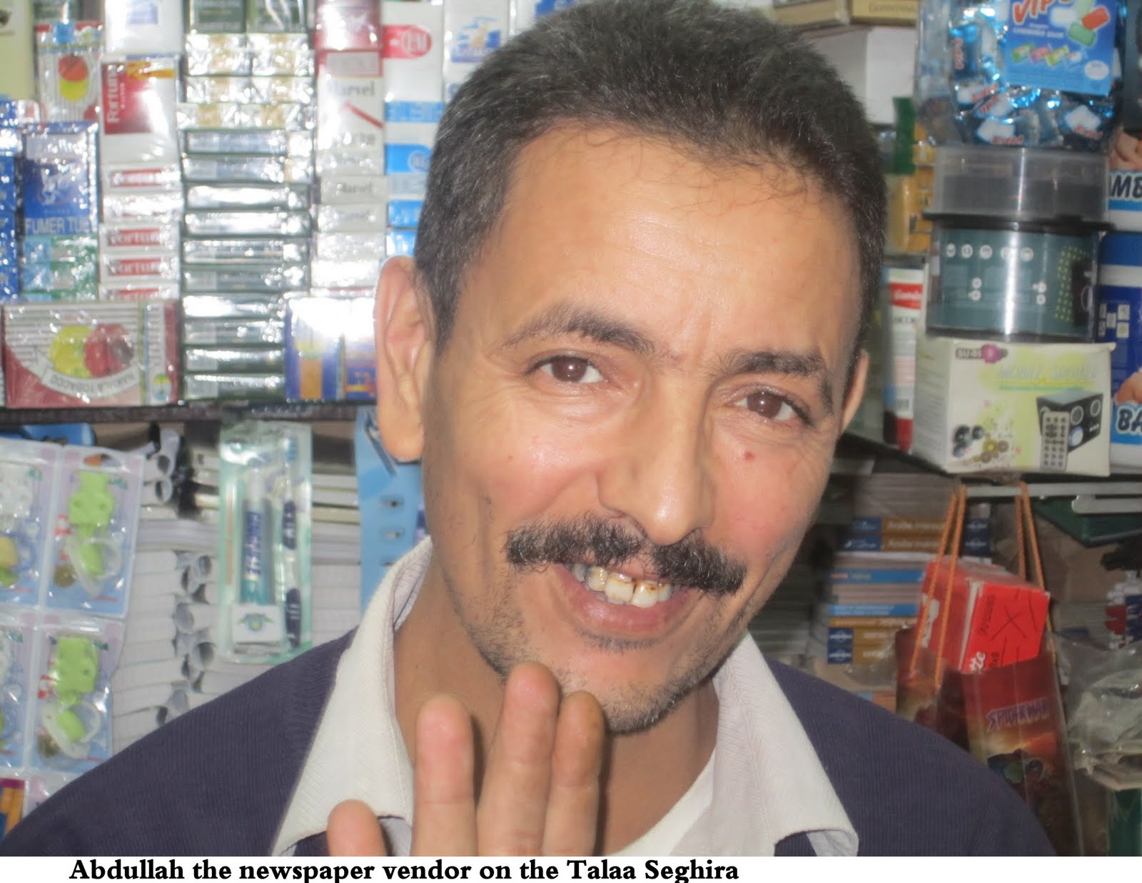 Abdullah+the+butcher+scars