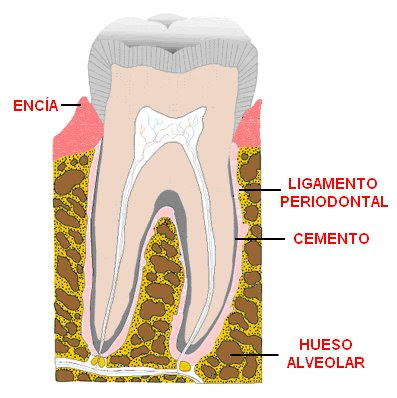 Gonfosis
