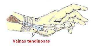 vainas tendinosas de la mano