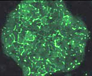 Liver cells in the micropatterned co-culture
