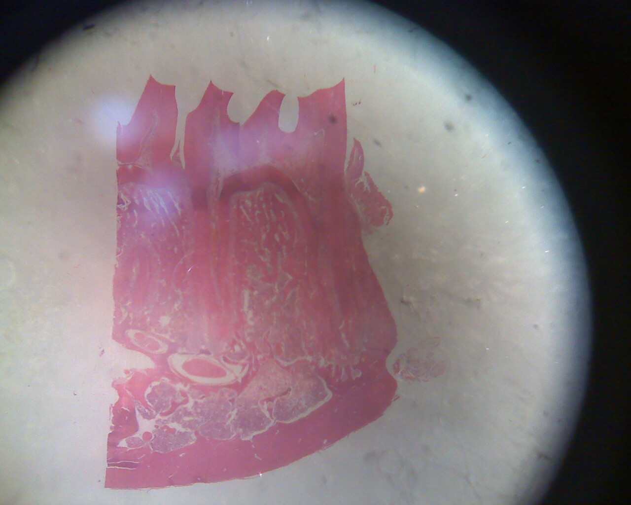 Tinción hematoxilinaeosina GENeracion 2010