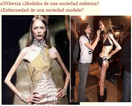 anorexia nervosa paper thesis Anorexia nervosa – treatment expectations, outcome and treatment expectations, outcome and satisfaction the focus of this thesis is anorexia nervosa and. anorexia nervosa paper thesis Anorexia nervosa – treatment expectations, outcome and treatment expectations, outcome and satisfaction the focus of this thesis is anorexia nervosa and.