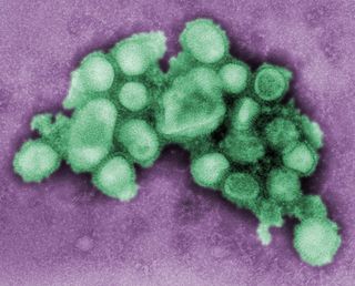 [H1N1.jpg]